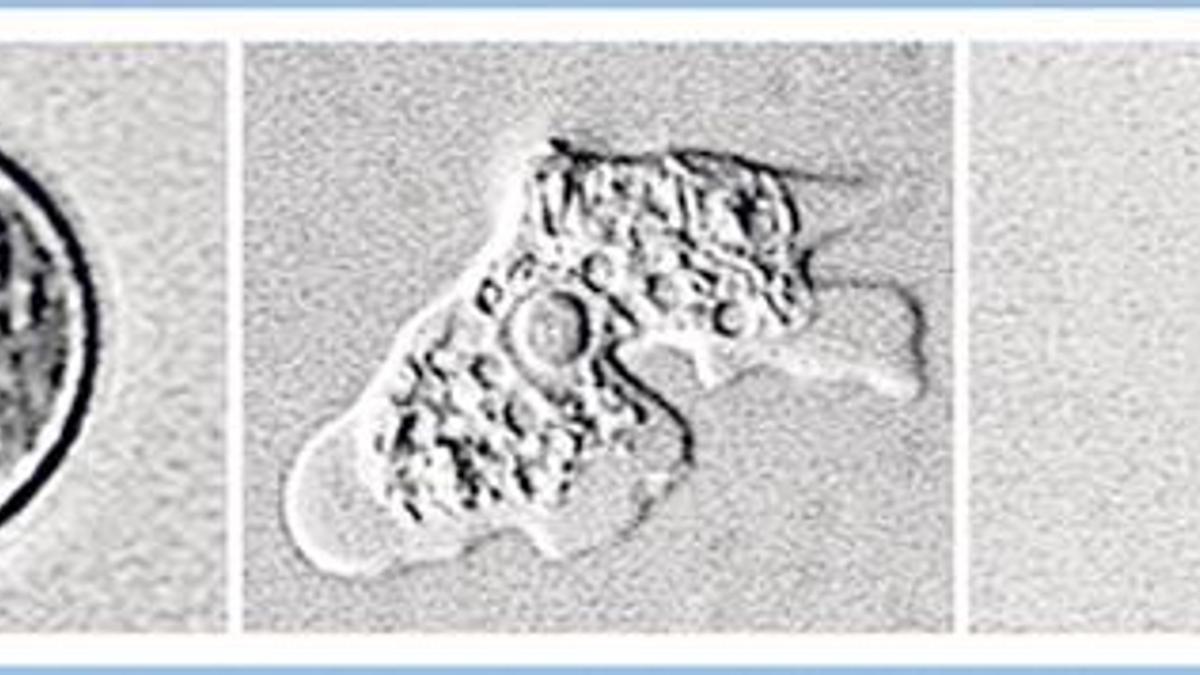 Beyin yiyen amip paniği