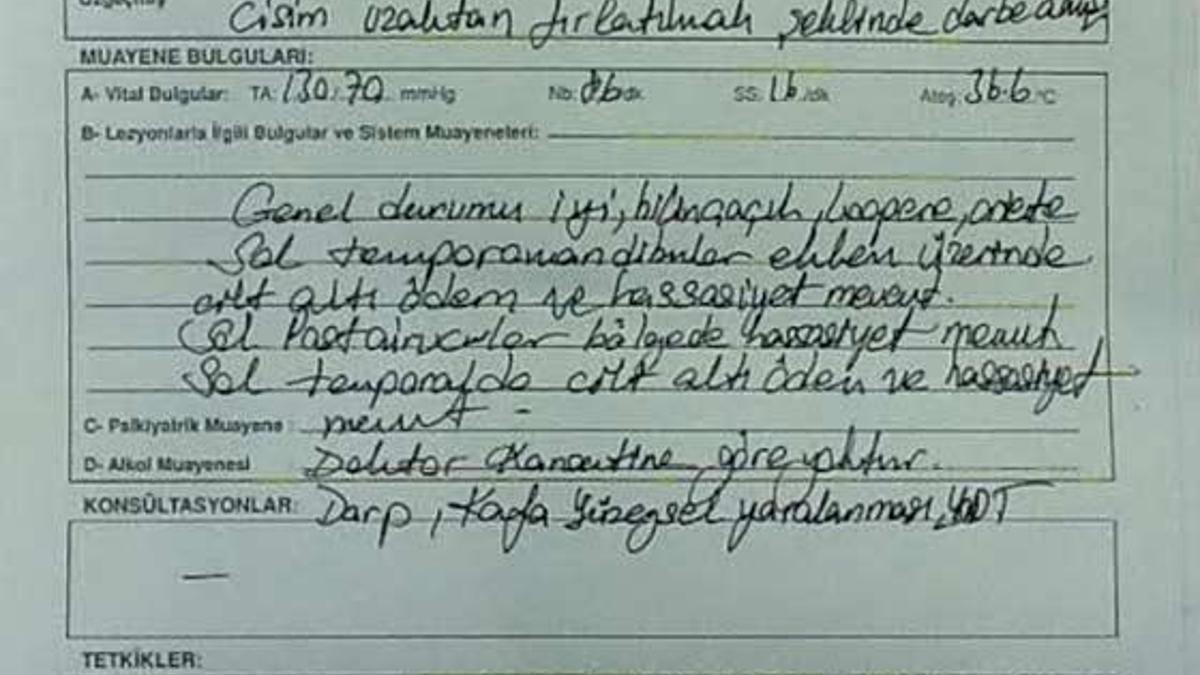 CHP'li vekile iş göremez raporu!