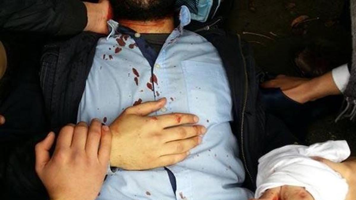 Üniversitede kanlı sağ-sol kavgası!