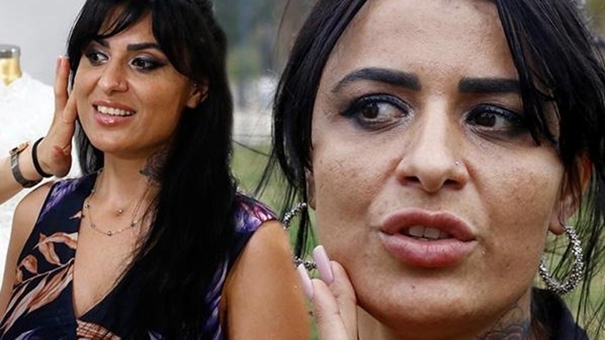 Gittiği güzellik merkezinde kabusu yaşamıştı! Bu yöntemle iyileşiyor
