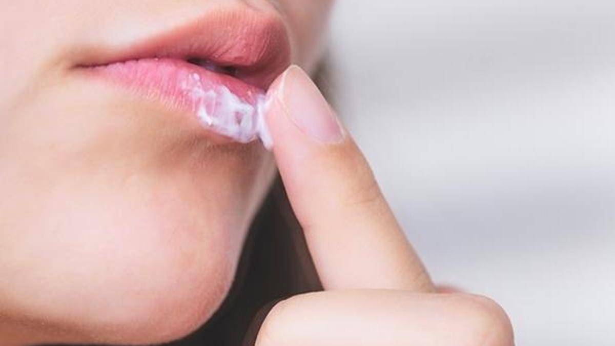 Düşük bağışıklık sistemi uçuk oluşumuna neden oluyor