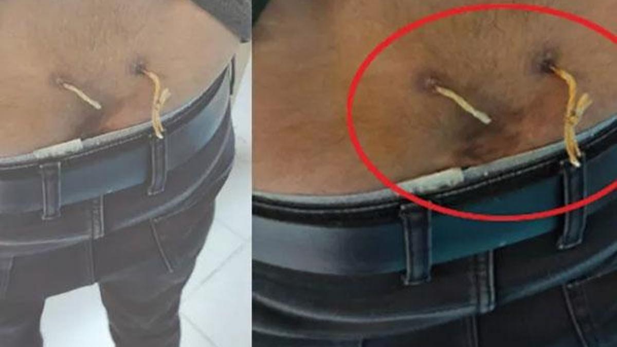 Çamaşır ipiyle tedavi adı altında işkence!