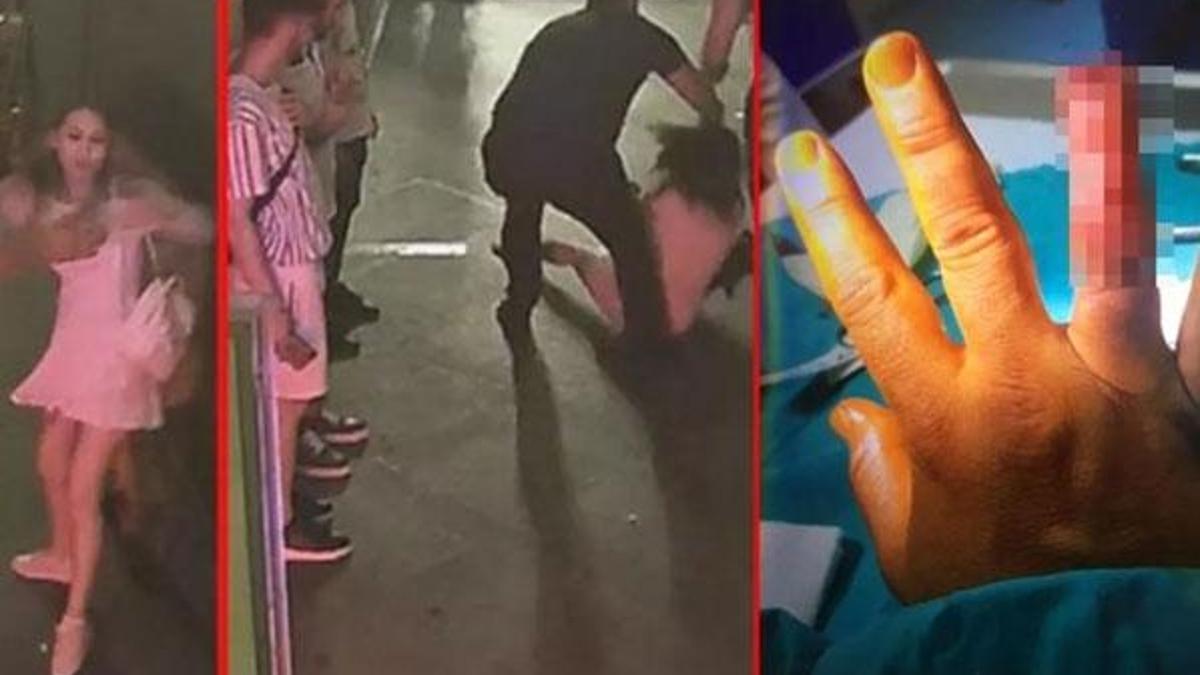 Güvenlik görevlisinin parmağını koparmıştı! O turistler ilk kez konuştu