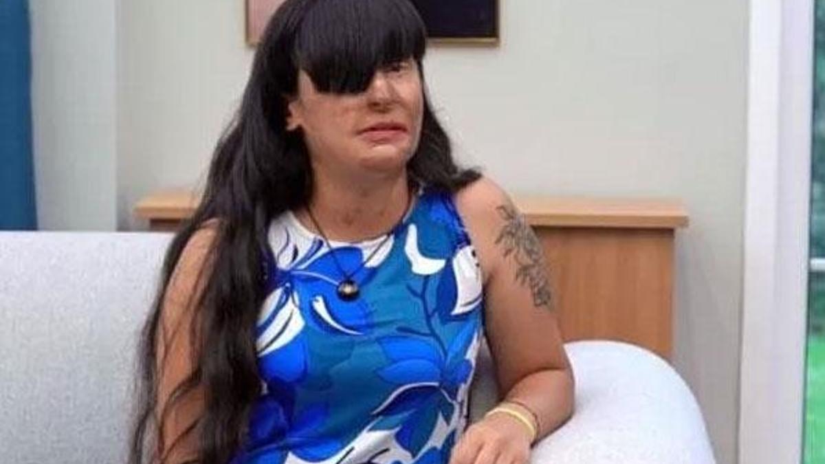 Yüzüne kezzap atan eski sevgilisini affetmişti! İlk kez konuştu
