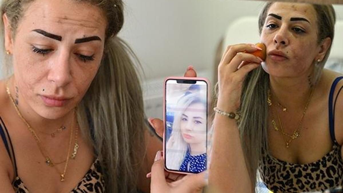 Güzellik merkezine gitti, kabusu yaşadı! 'Lüks mekan diye aldandım'