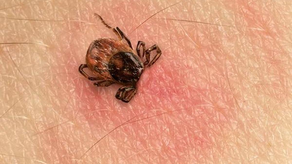 Lyme hastalığı nedir, belirtileri nelerdir? Lyme hastalığı nelere yol açar?
