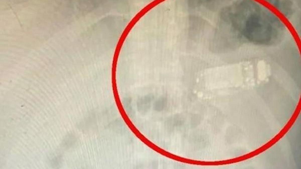 Doktorlar şok oldu! En son versiyonu hastanın midesinden çıktı