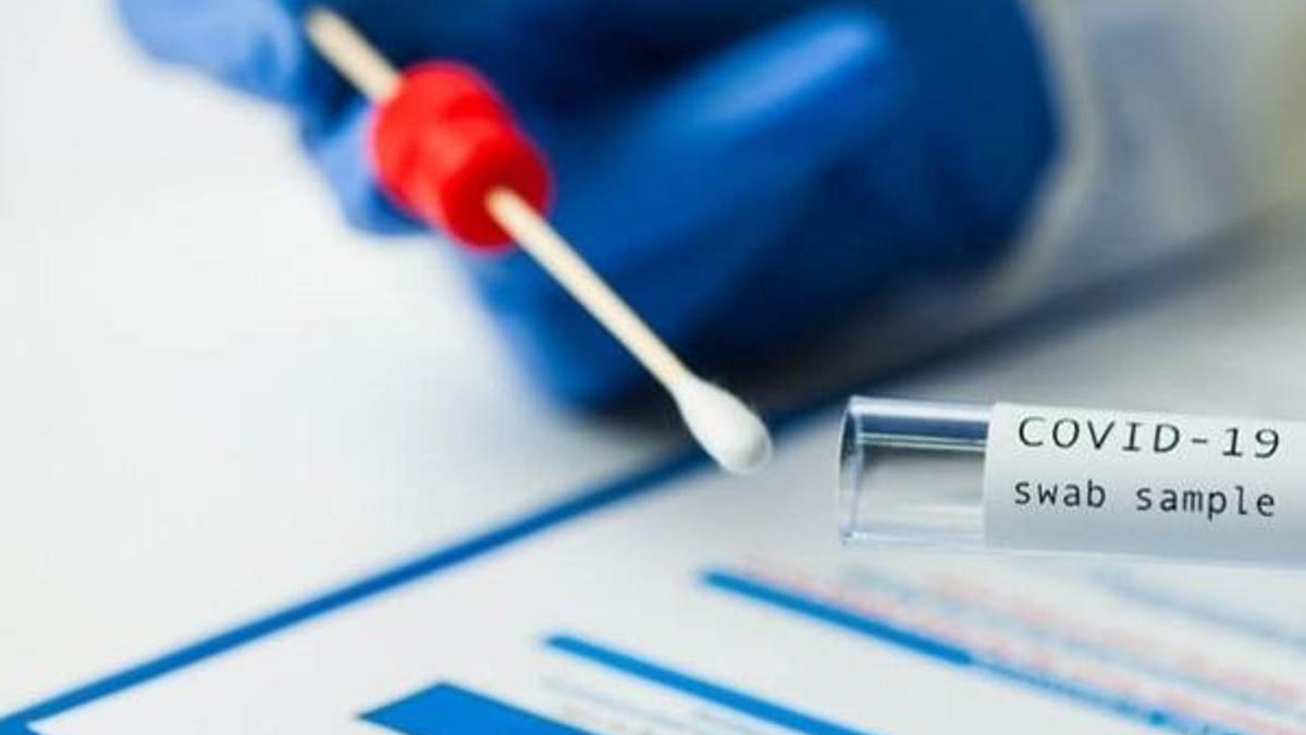 AVM PCR testi zorunlu mu? PCR testi nerelerde zorunlu? Negatif PCR testi zorunluluğu