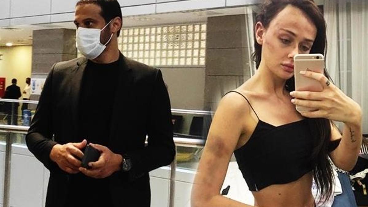 Model sevgilisini dövüp saatlerce odaya kilitlemişti! Flaş gelişme