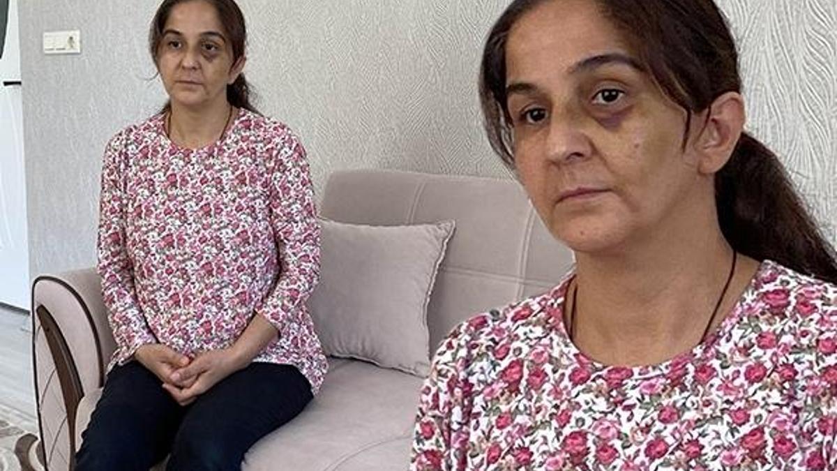 Eşinden yıllardır şiddet görüyor! 'Hamileyken bile dayak yedim'