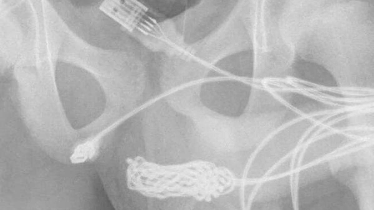 'Ölçmek' için yaptı! Cinsel organından çıkan şey şok etti