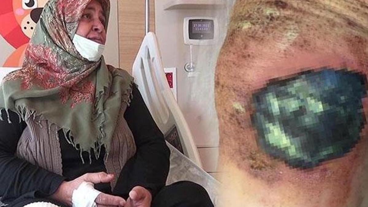 Toz haline getirip bacağına sardı! Hayatı karardı