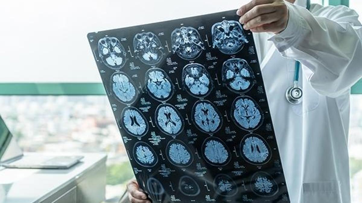 Beyin pili ağır depresyona da umut olabilir