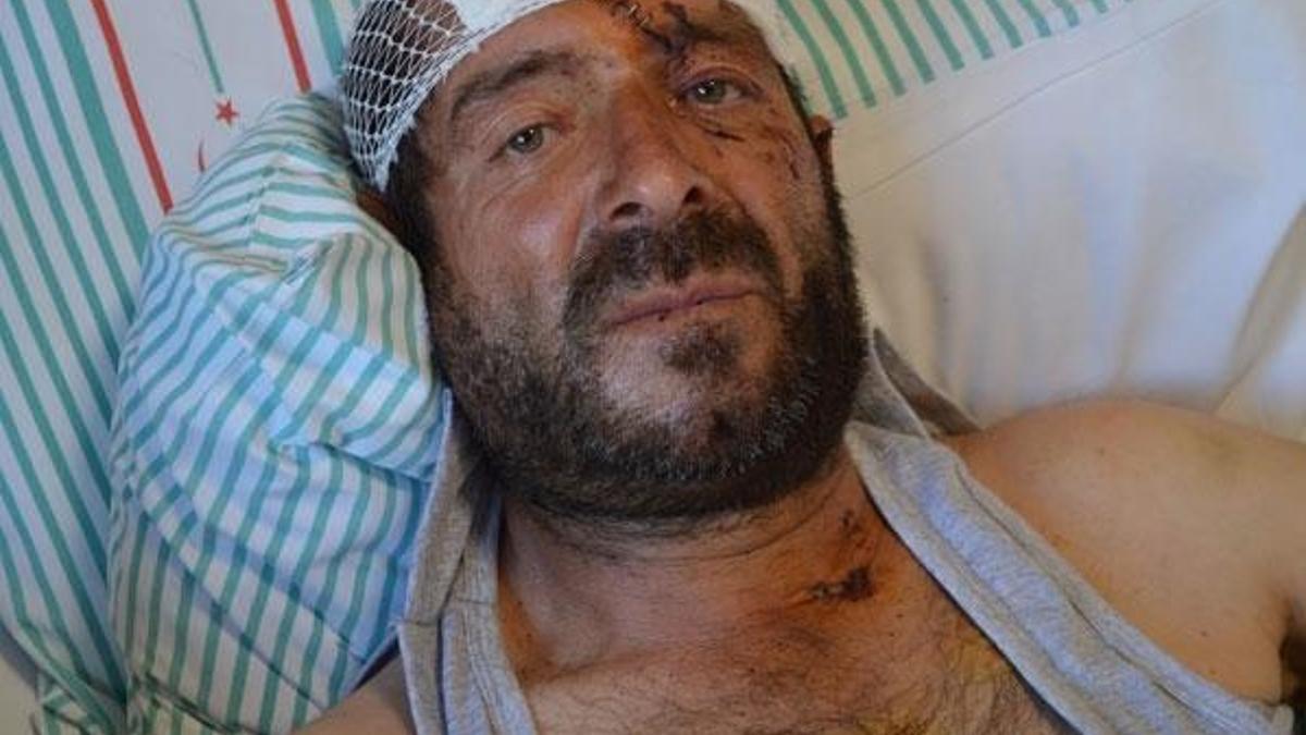 Yaylada birden üzerine atladı! Dehşet anlarını anlattı! Ayı saldırısı