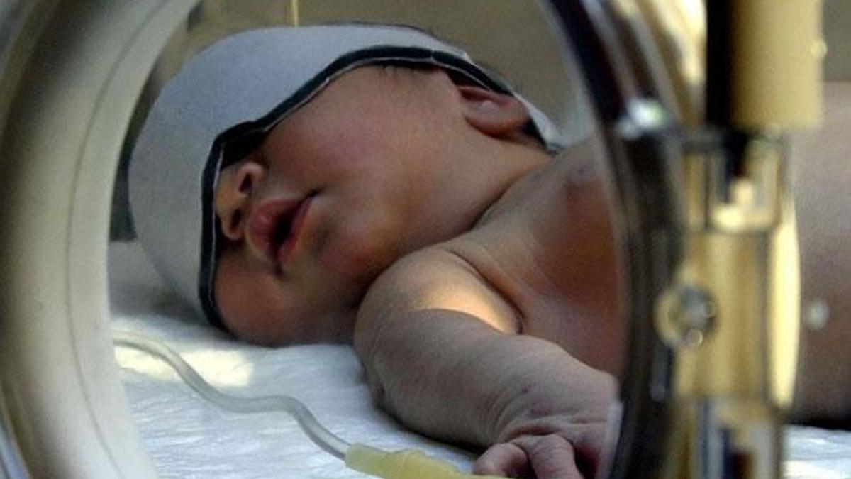 Hayatın ilk 6 ayından sonraki şaşılık tedavi gerektiriyor