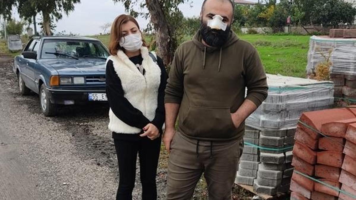 Pitbull vahşeti! Sevmek için eğilince burnunu kopardı