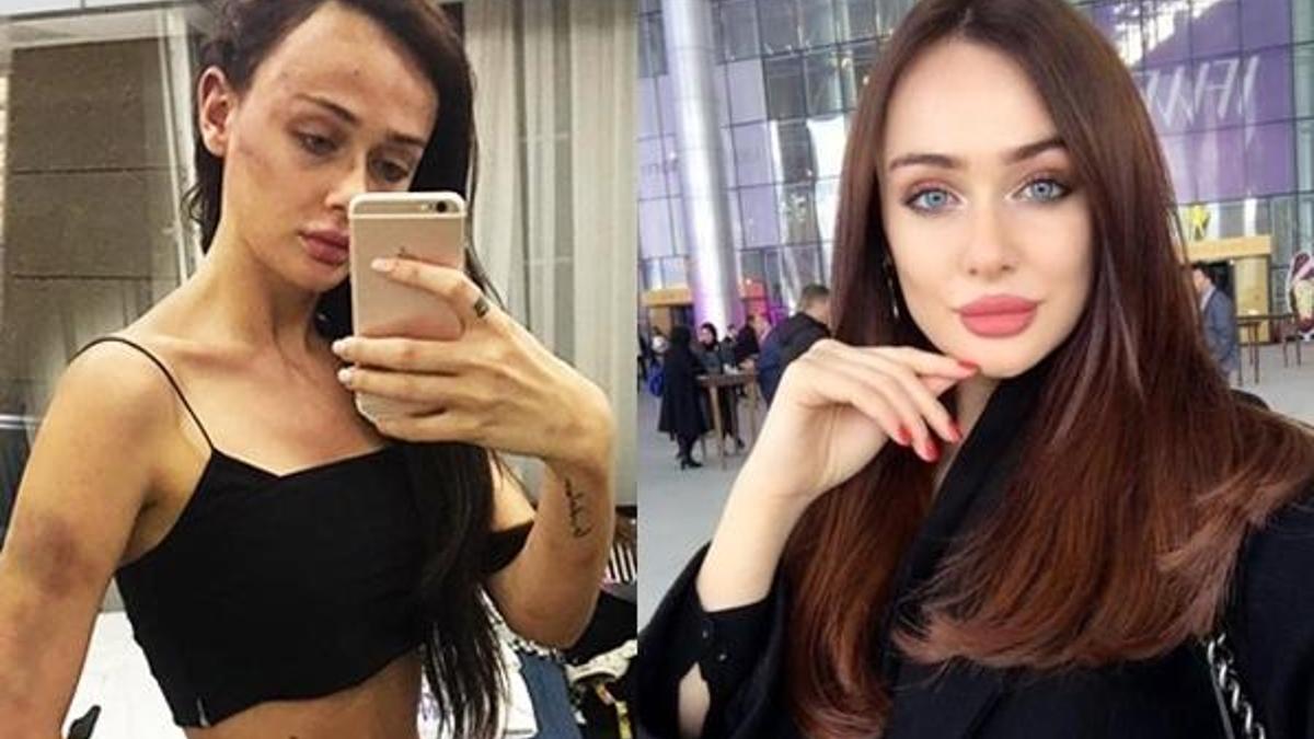 Sırp model Tanja Dukiç'e şiddet davasında flaş gelişme