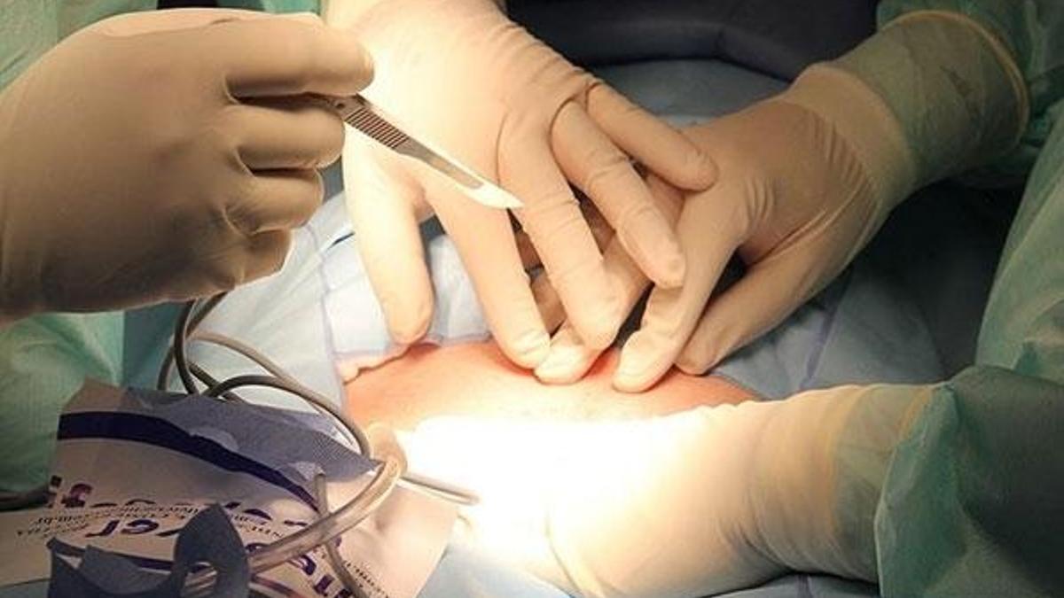26 bin 894 kişi organ nakli bekliyor