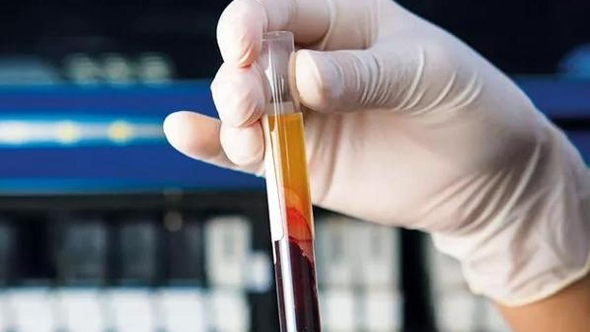 Kanser teşhisinde ezberler bozuluyor! Kan testi...