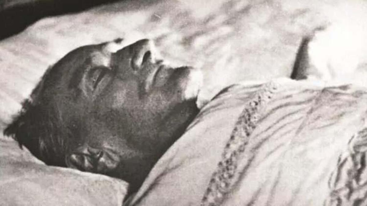 Atatürk neden öldü? Atatürk’ün hastalığı siroz nedir, siroz hastalığı neden olur, belirtileri nelerdir?