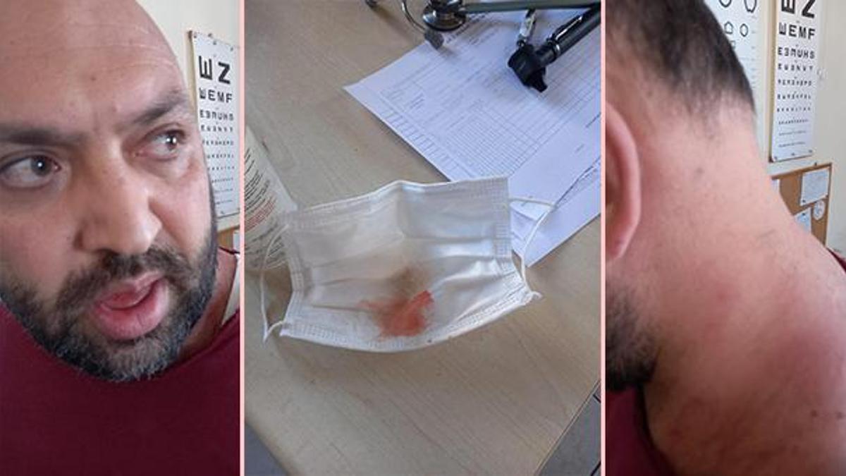 Kayseri'de pes dedirten olay! İstediği ilacı yazmayan doktoru darbetti