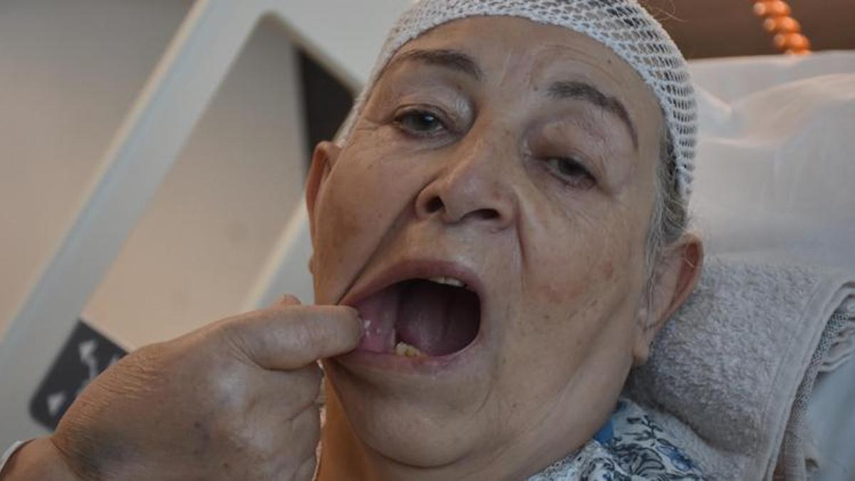 'Delirten hastalık'ta 5 dişinden oldu