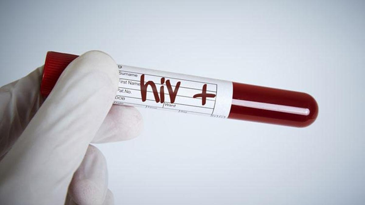 HIV virüsü tanıda geç kalınırsa AIDS’e dönüşüyor