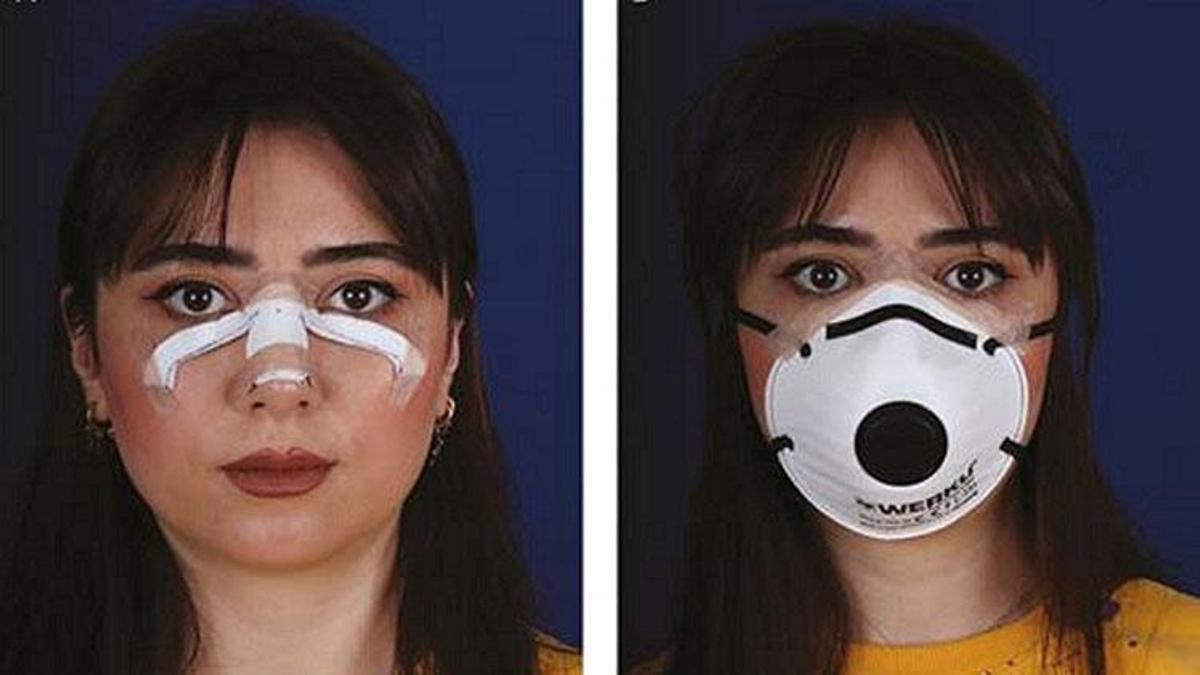 Maske nedeniyle yüzde oluşan kızarıklığa çözüm!