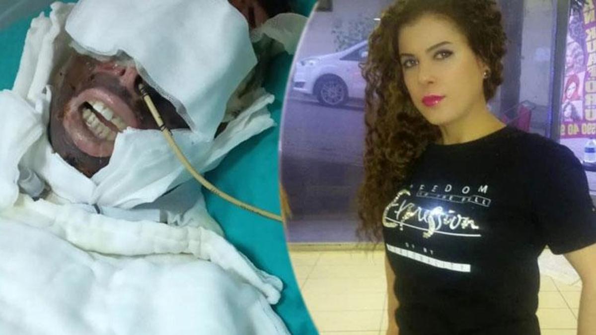 Avcılar'da sevgilisinin üzerine kimyasal madde döken saplantılı aşık için istenen ceza belli oldu