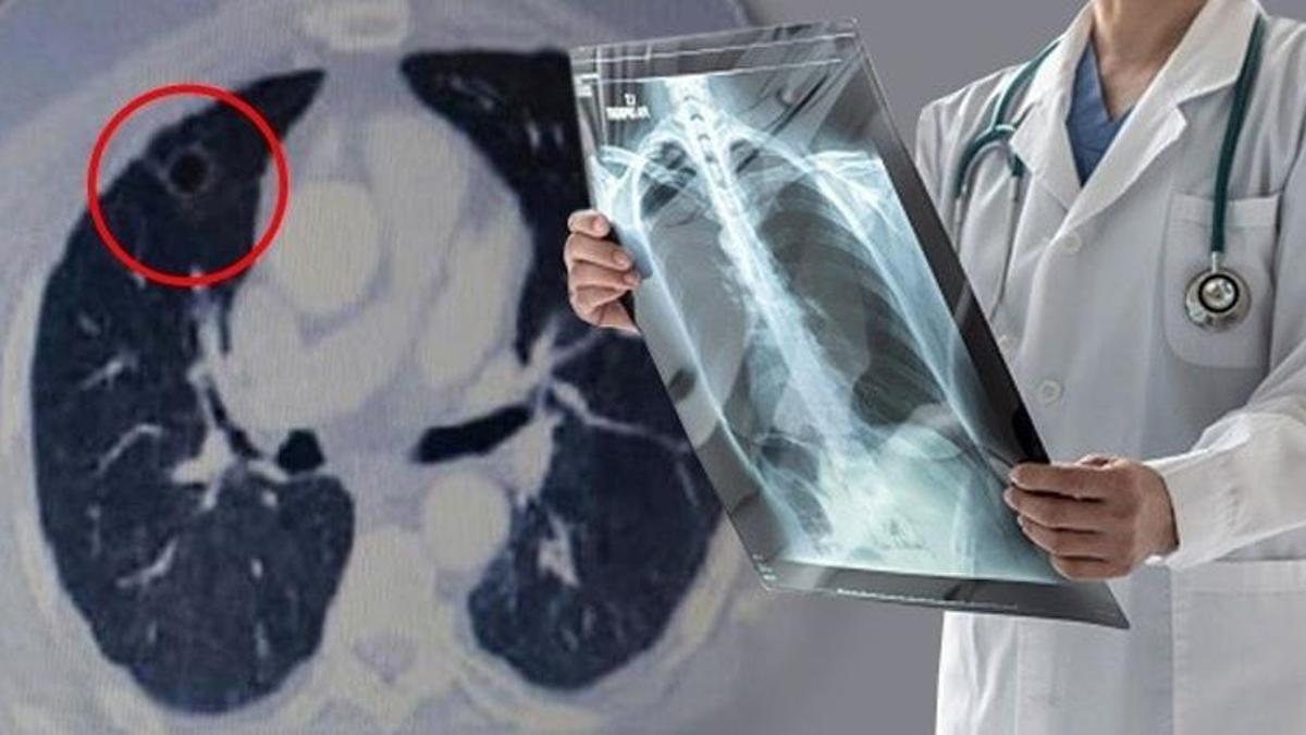 Uzmanından ciğerlerinizi Covid'e hazırlayan nefes egzersizleri