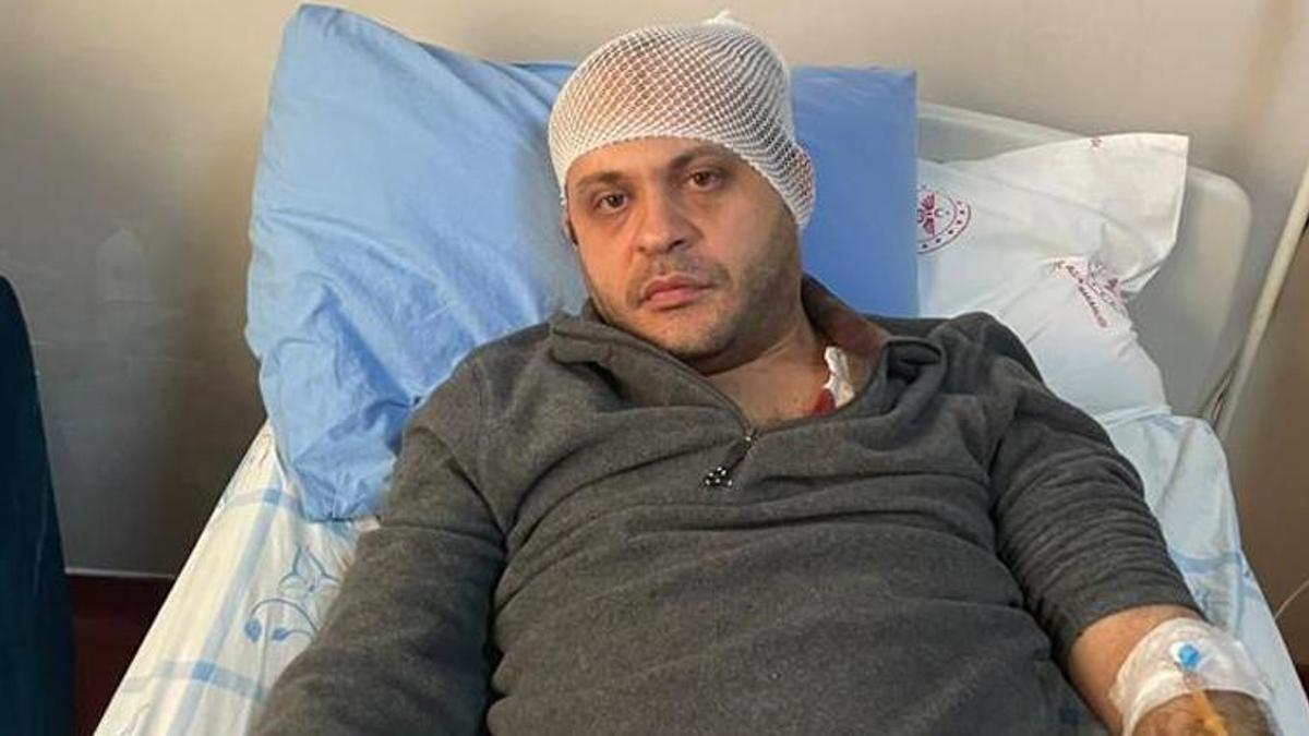 Mermer aksesuarla doktoru başından yaraladı