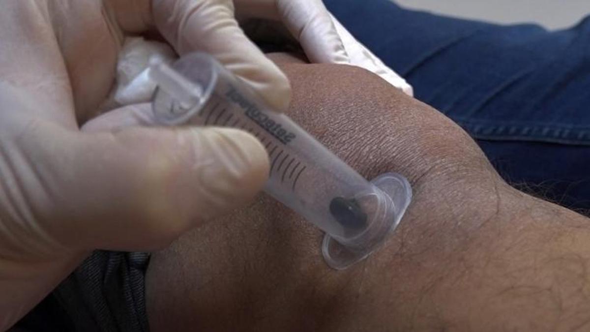 Doktor sülükler şifa kaynağı