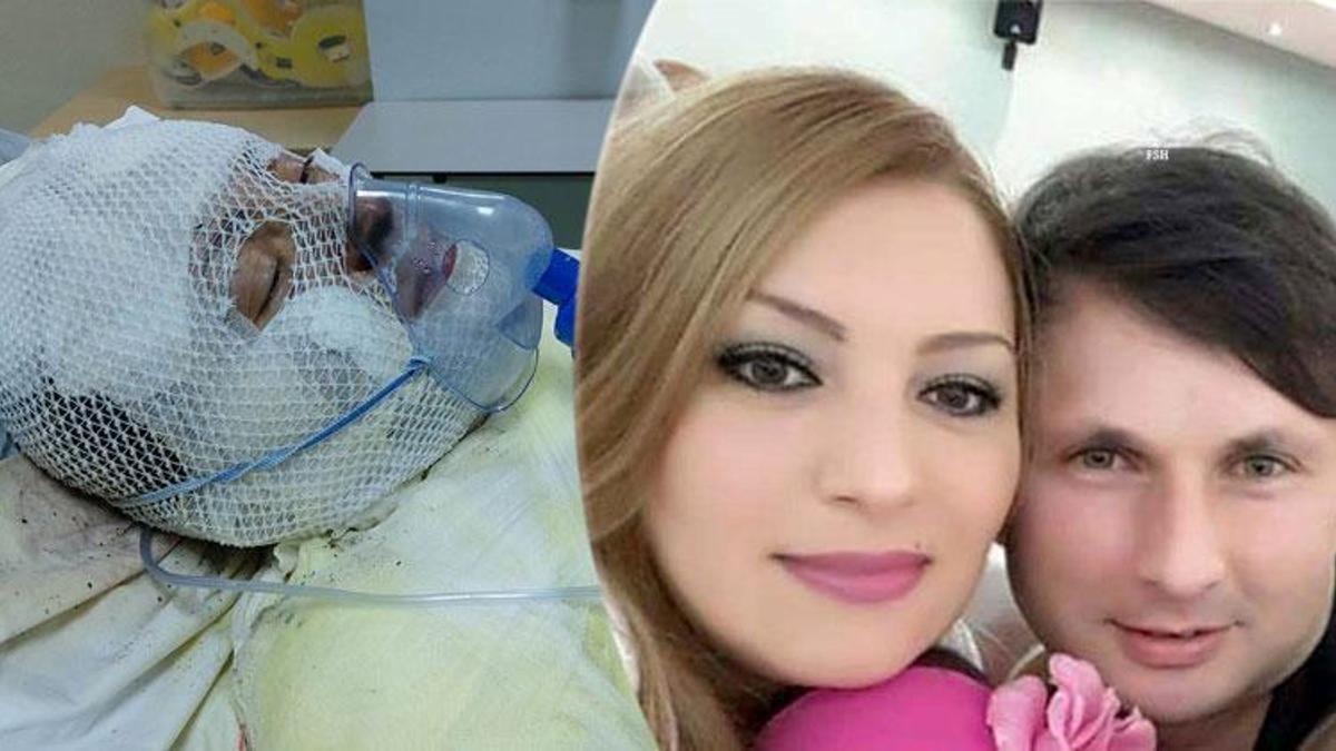 Boşandığı karısını 'Ya benimsin ya toprağın' diyerek yanıcı madde dökerek yaktı