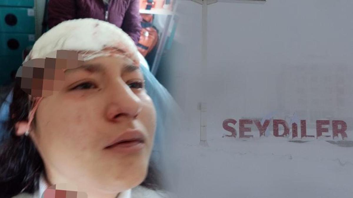 Özçekim yaparken ölümden döndü! Sokak köpekleri...