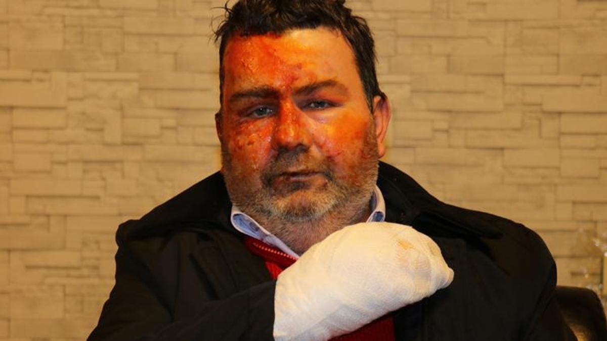 Uykuda kardeş dehşeti! 'Oh ne iyi yaptım, seni yaktım'