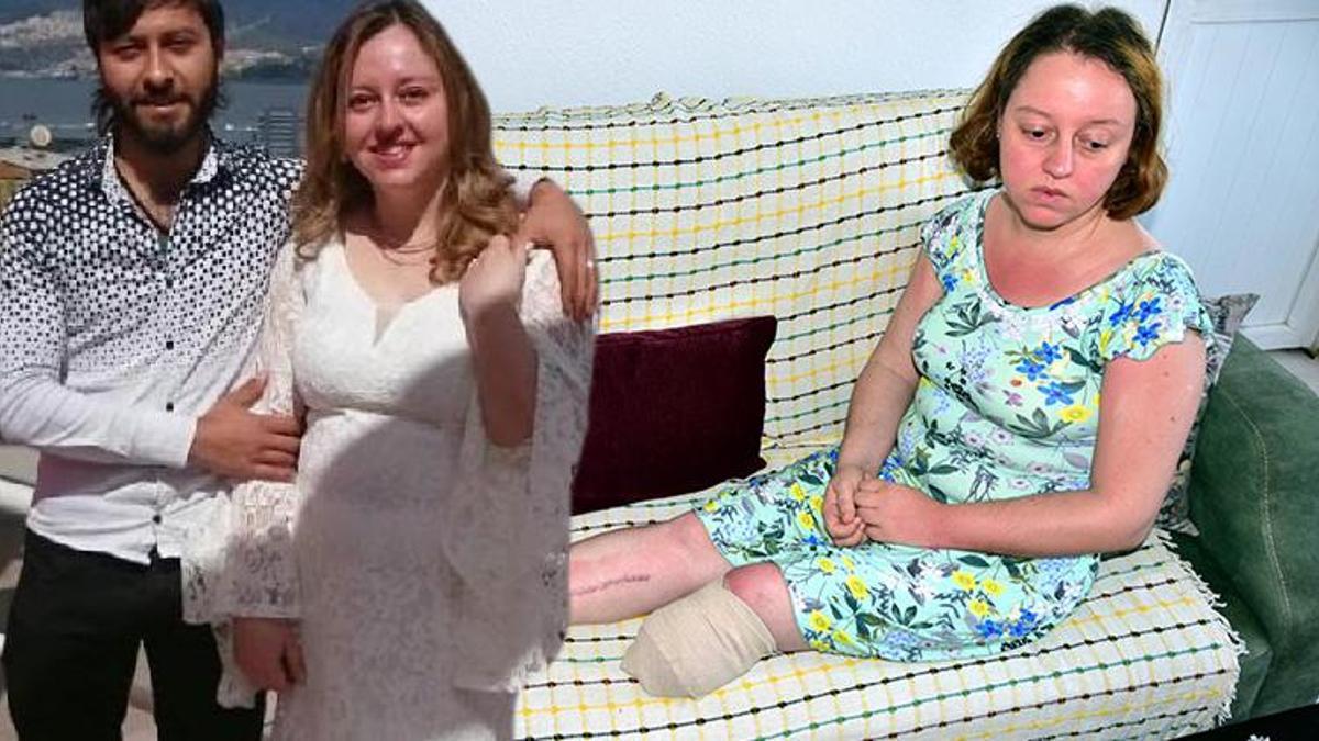 Eşini vurup bacağının kesilmesine neden olmuştu! Savcı 20 yıla kadar hapis istedi