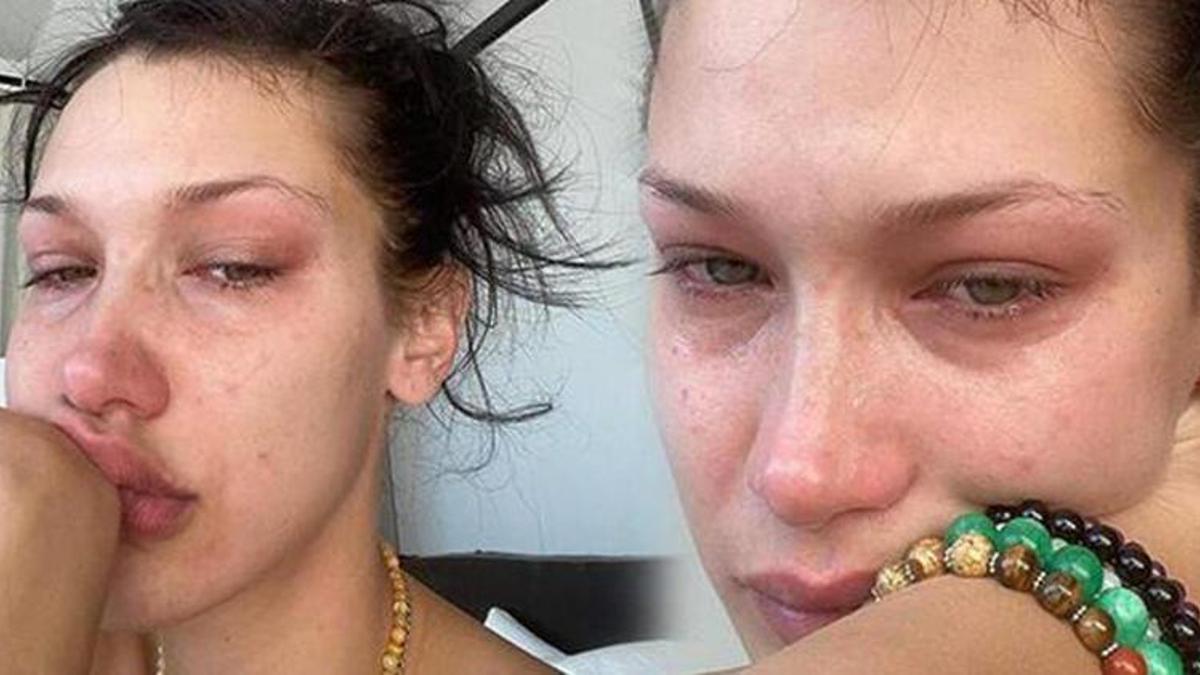 Bella Hadid: Çocukken ailenin utanç kaynağı gibi hissediyordum