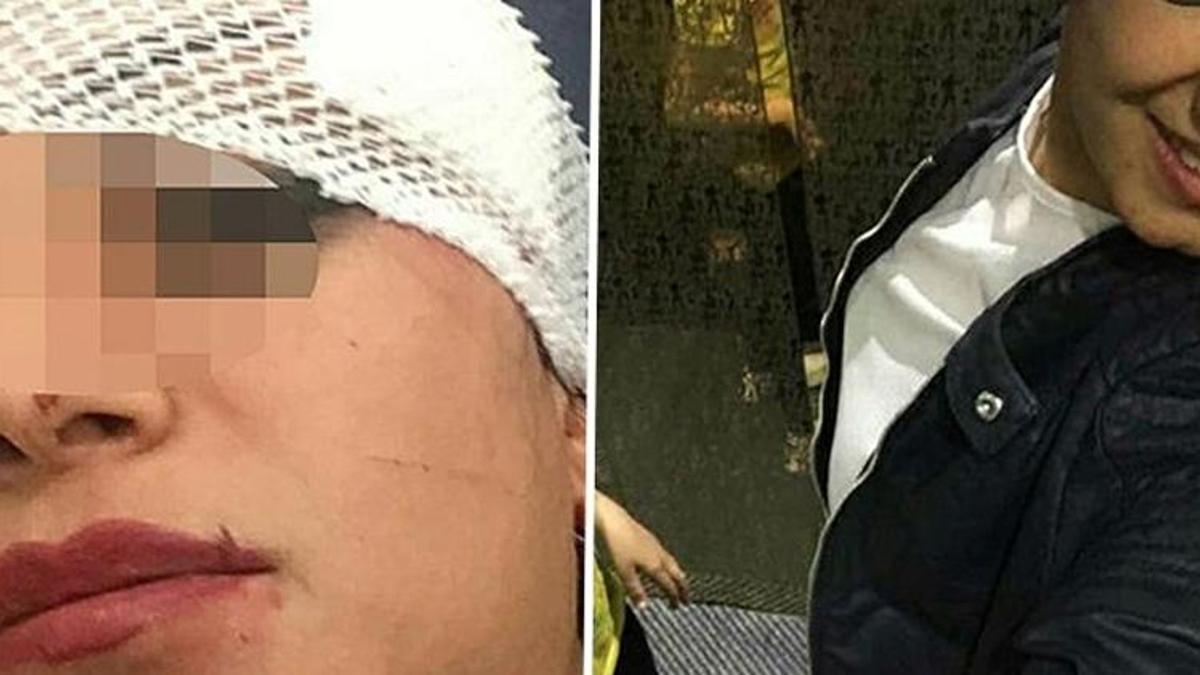 Eski eşiyle ilişkisi olan arkadaşını jiletle kesti!