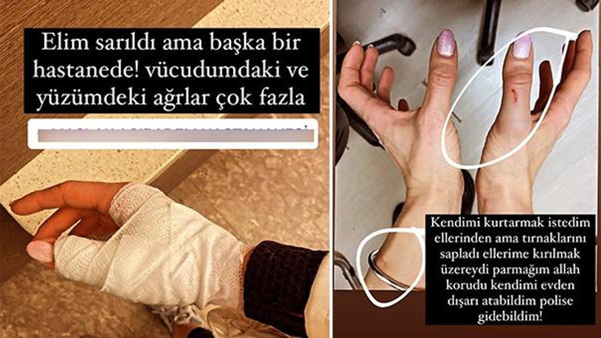 Futbolcu Özer Hurmacı eşini darp etti iddiası: Sen bir canavarsın