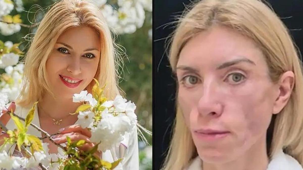 Rus güzellik kraliçesi Yulia Tarasevich’in hayatı kabus oldu! Gözlerini kapatamıyor