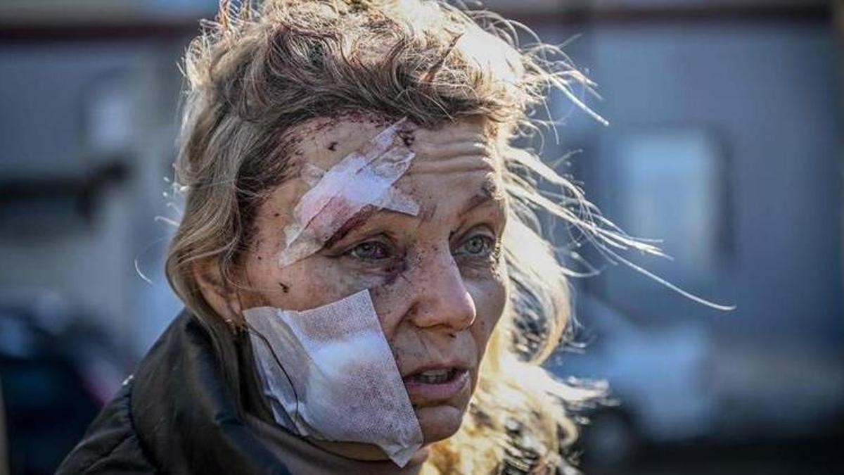 Ruslar, savaşın simge ismini hedefe koydu! Ukraynalı Olena Kurilo video ile cevap verdi: Ben bir füze saldırısının kurbanıyım