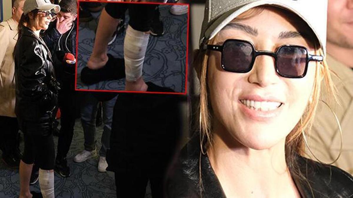Hande Yener ayağı sargılı ödül töreninde! "Bacak nazarmış öyle diyorlar"