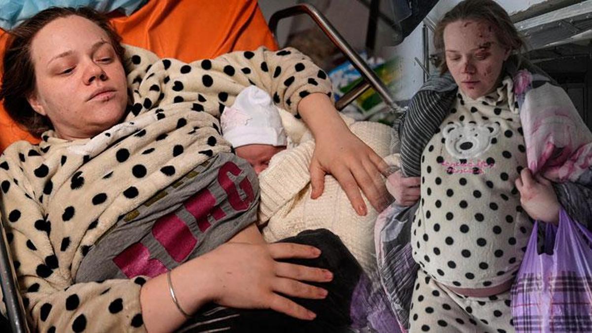 Rusya bombalanan hastaneden kurtulan kadını hedefe koydu! Mariana Vishegirskaya tek fotoğrafla savaşın sembolü olmuştu...