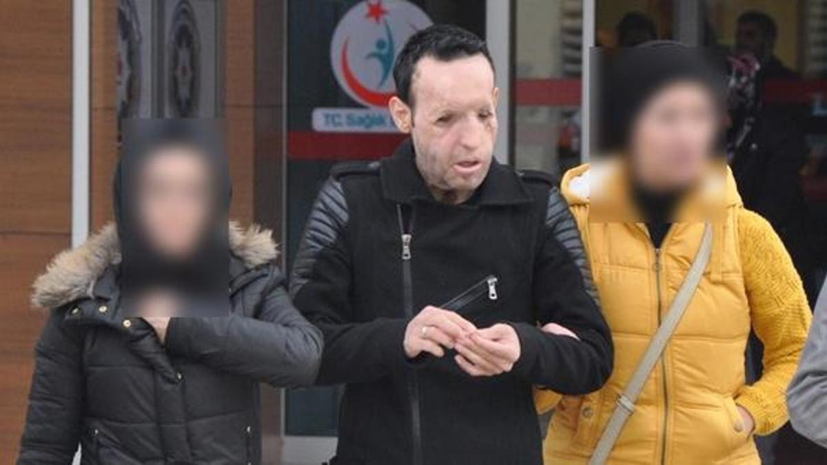 Yüz nakli yapılan Recep Sert gözaltına alındı