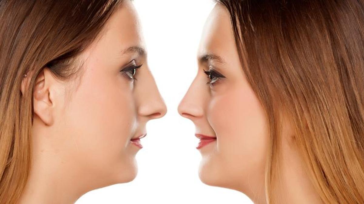 Profil estetiği nedir?
