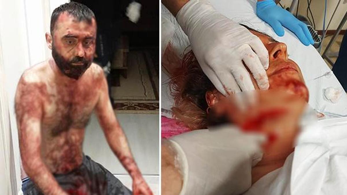 Maket bıçaklı saldırı! Eski eşine ve kocasına dehşeti yaşattı