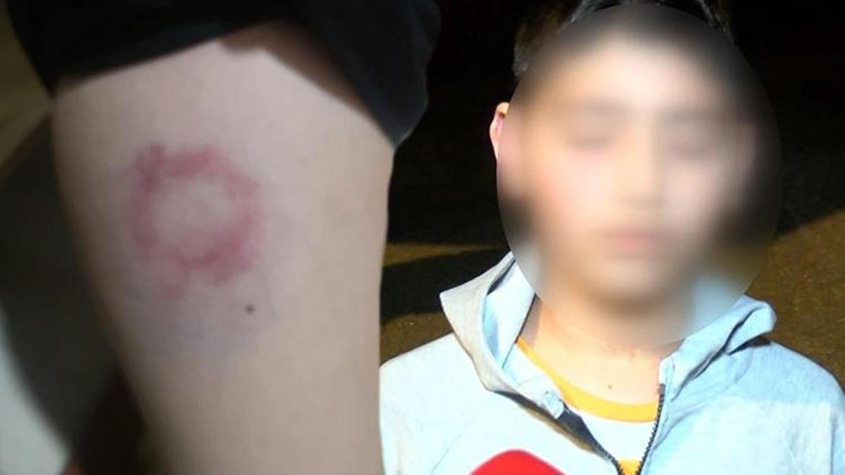 İki kardeş saldırıya uğradı iddiası! 'Annesi beni yerde tutarken çocukla birlikte yumrukluyorlardı'