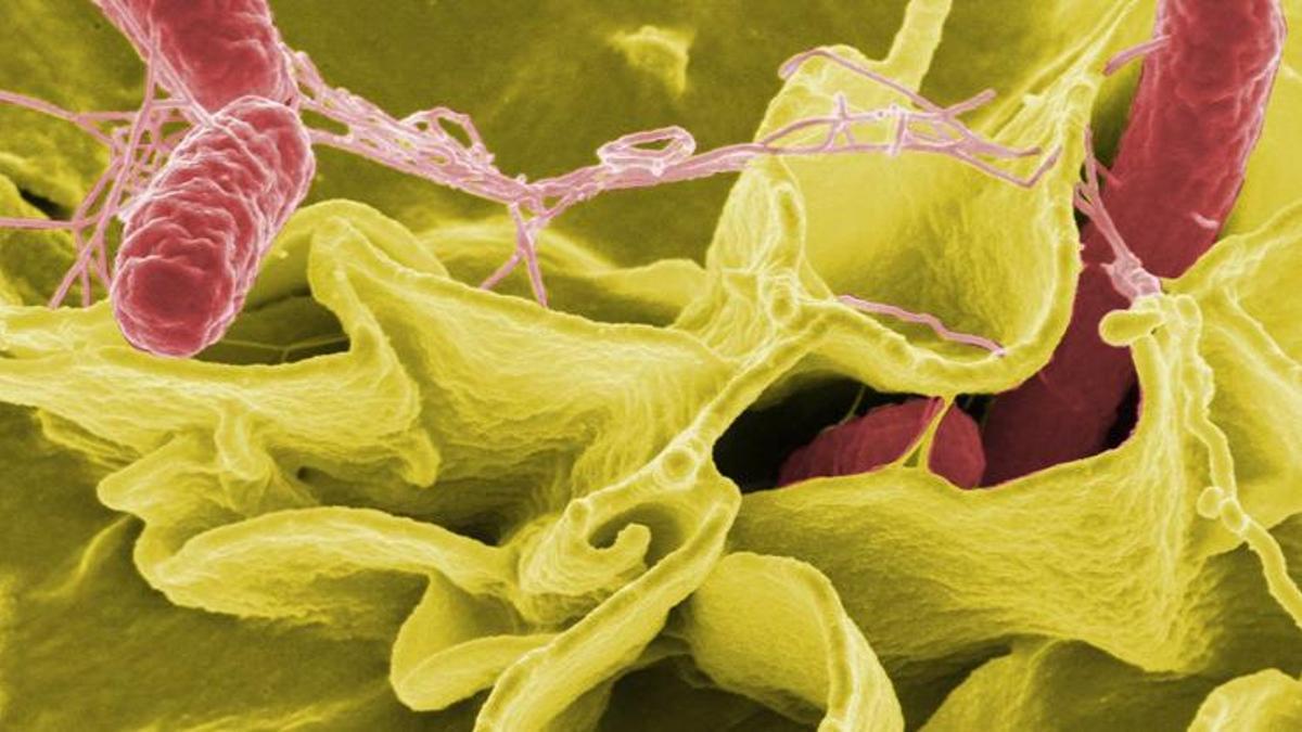 DSÖ: 11 ülkeden 151 Salmonella vakası bildirildi
