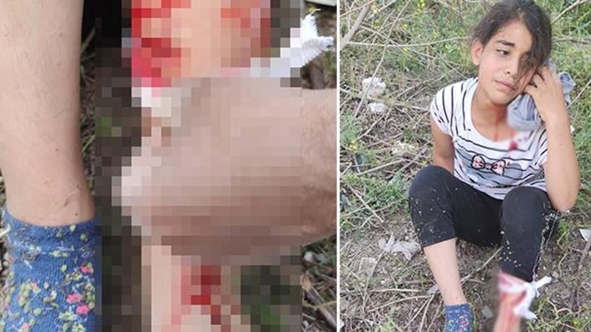 Başıboş köpekler küçük kıza dehşeti yaşattı! Birçok yerinden yaralandı