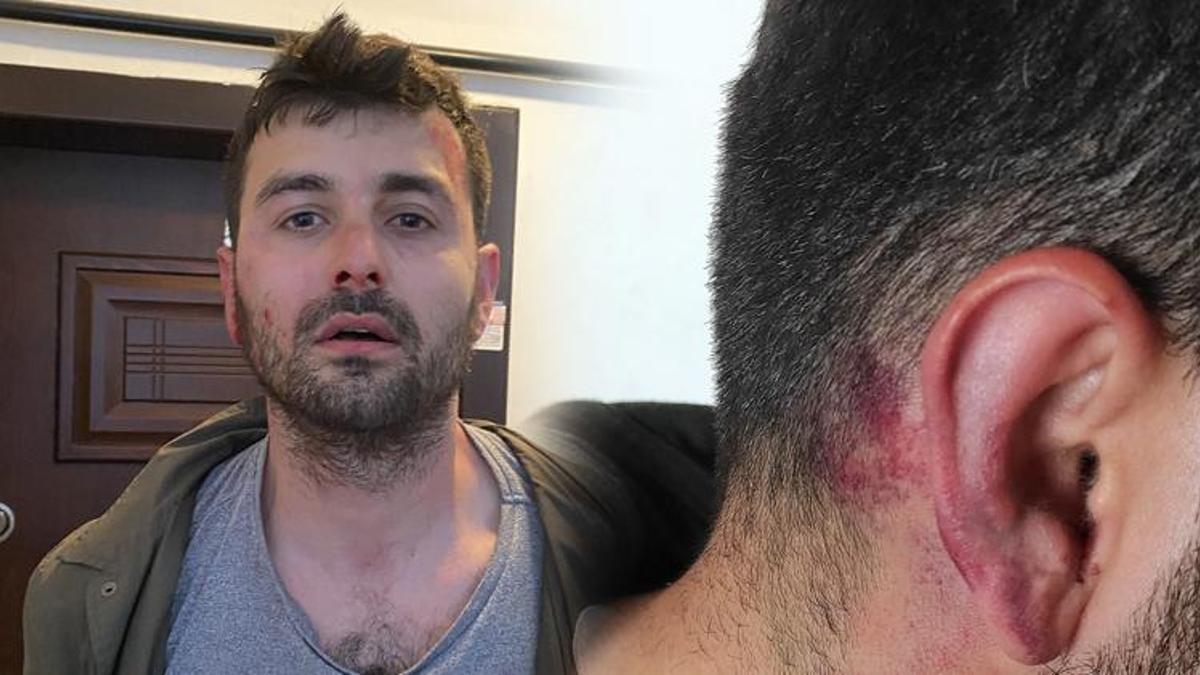 Futbolcu Veysel Sarı'nın kardeşinden kiracıya dayak!